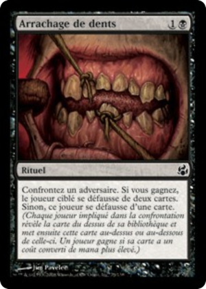 0b1f0290-9691-41af-a61f-d0bf94a99feb Pulling Teeth